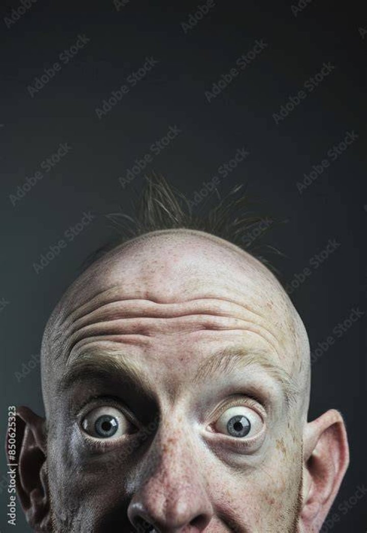 a very ugly bald man ;) Ok Wierdos. Did you know that I kn… Flickr