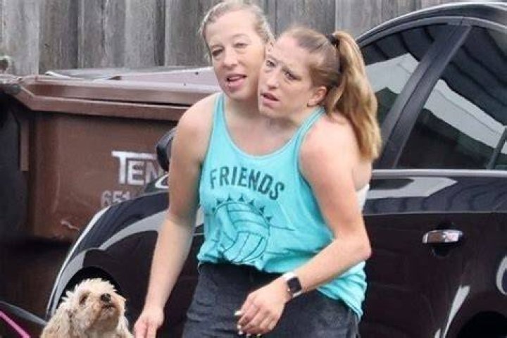 Are abby and brittany hensel conjoined twins married legsbm