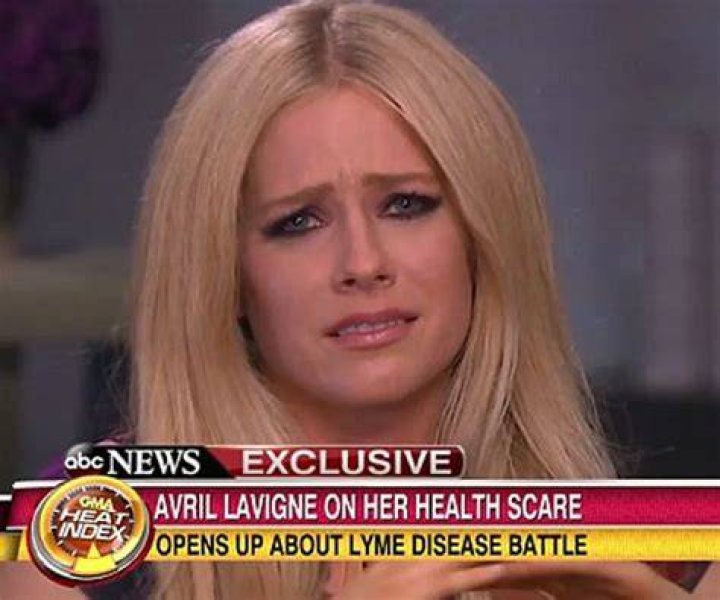 Avril Lavigne’s Lyme Disease Tweet To Hailey & Justin Bieber See It