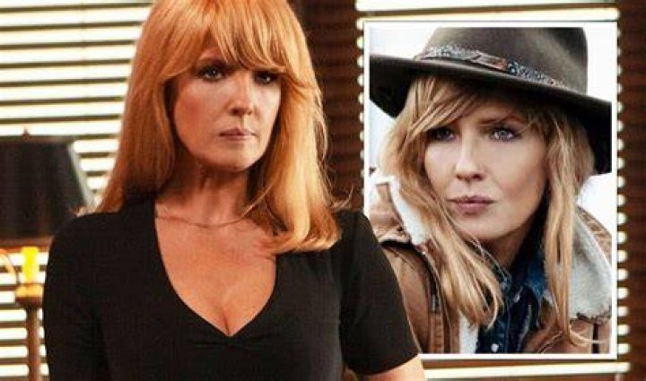 Beth Dutton Lip Surgery Before And After Photos