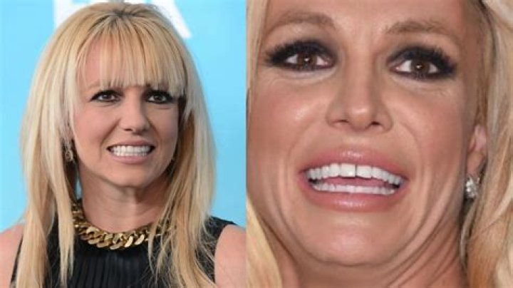 britney spears teeth p&egrave;re de britney spears Genertore2