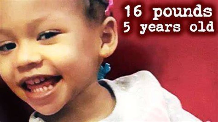 Cali Anderson Autopsy Unveils Hidden Insights