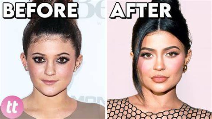 Camille Fishel Plastic Surgery Before And After Photos