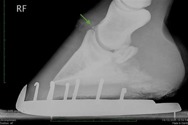 Can a horse recover from a broken pastern?