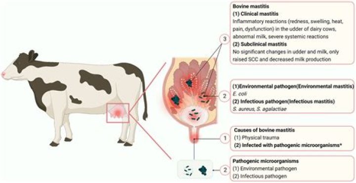 Can tuberculosis cause mastitis?