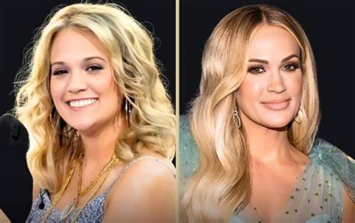 Carrie Underwood plastic surgery what has she had done? HELLO!