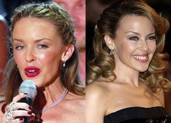 Chatter Busy Kylie Minogue Plastic Surgery