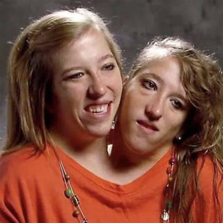 Conjoined Twin Sisters Abigail And Brittany Hensel Ha vrogue.co