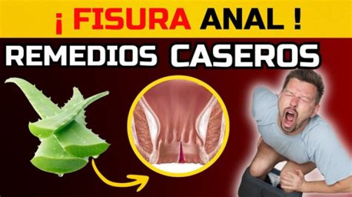 Cuando se cura la grieta anal?