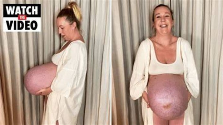 Danish mum expecting triplets goes viral on TikTok