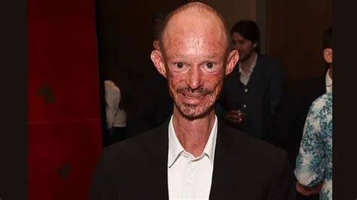 Darren Kent cause of death What illness did Darren Kent have? ABTC