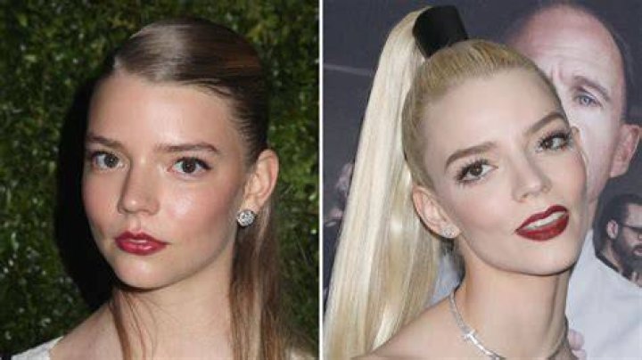 Did Anya TaylorJoy Get Plastic Surgery? See Photos of the Actress