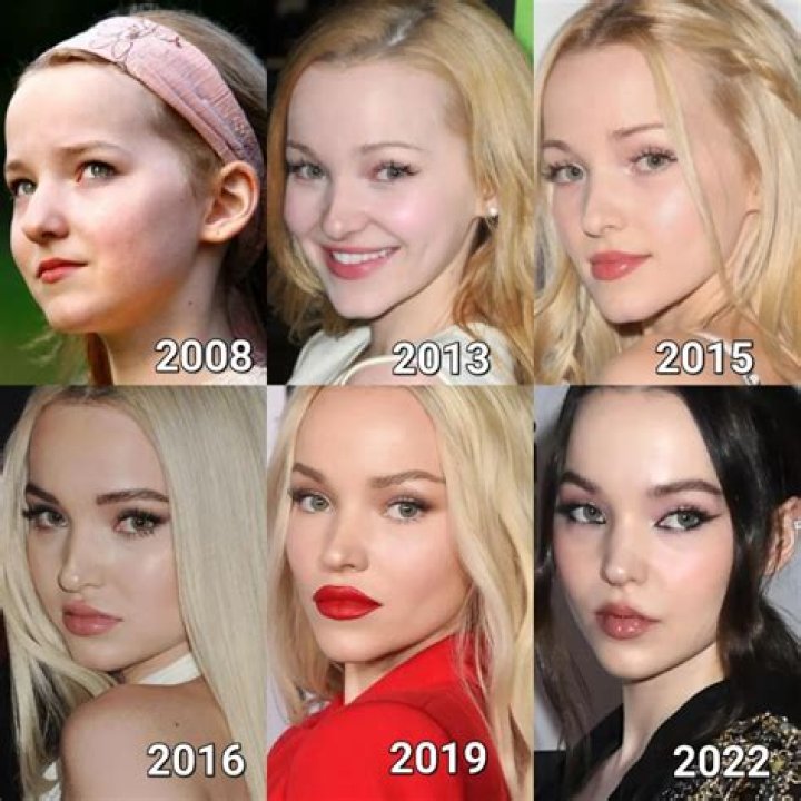 Did Dove Cameron Get Plastic Surgery? Then and Now Photos