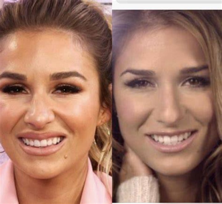 Did Jessie James Decker get Plastic Surgery?