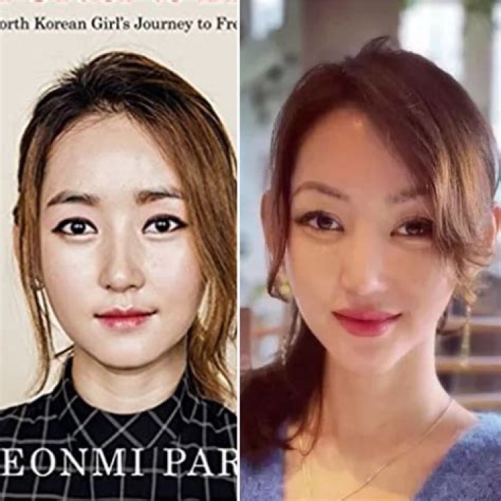 Did Yeonmi Park Had A Plastic Surgery? Is She Fake? Husband, Son And Instagram