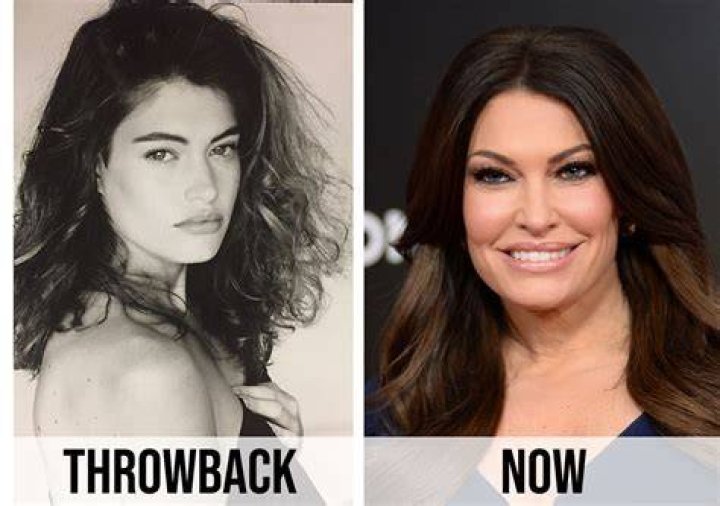 Guilfoyle Before And After: Unveiling Cosmetic Surgery's Impact