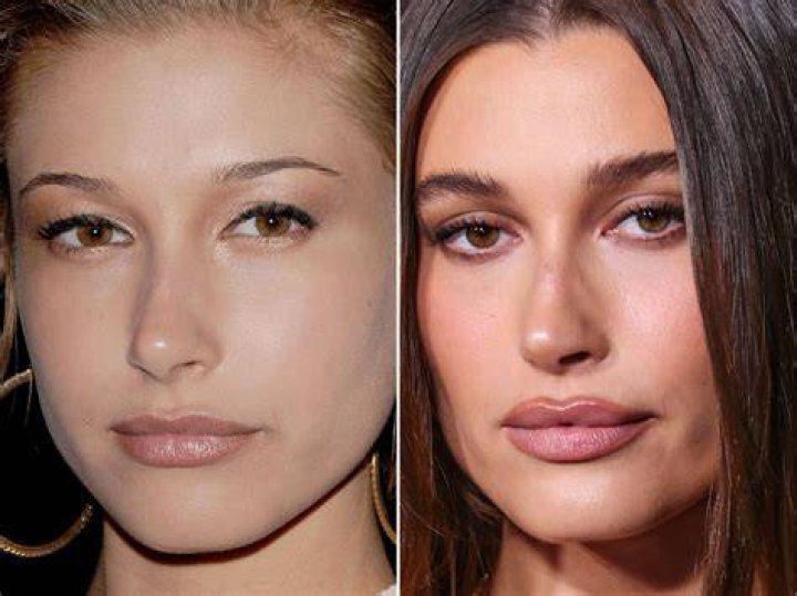 Hailey Bieber Before & After Beauty Transformation ELLE Australia