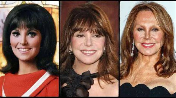 Has Marlo Thomas Had Plastic Surgery? Transformation Photos Closer Weekly