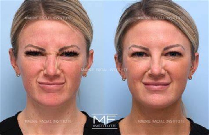 Has She Done Face Lift And Nose Job ·