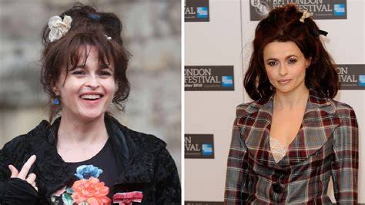 Helena Bonham Carter Surgery Before And After Photos