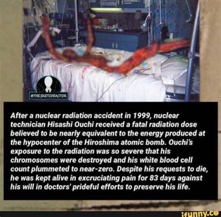Hisashi Ouchi And Radiation's Legacy