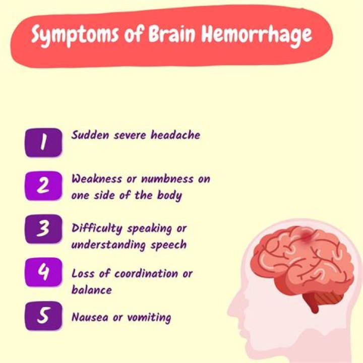 How do you tell if a baby has a brain bleed after a fall?