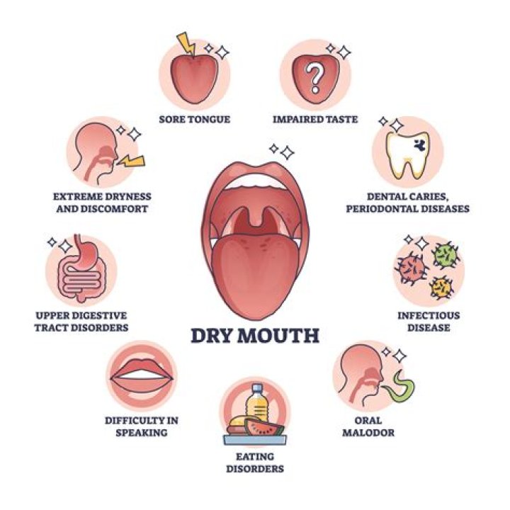Is dry mouth a symptom of autoimmune disease?
