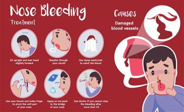 Is honking your nose bad?