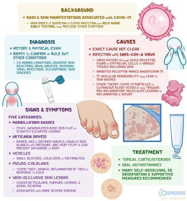 Is itchy runny nose a symptom of Covid 19?