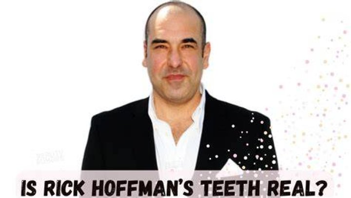 Is Rick Hoffman’s Teeth Real? Know the Truth Behind the Suits Cast’s Tooth!