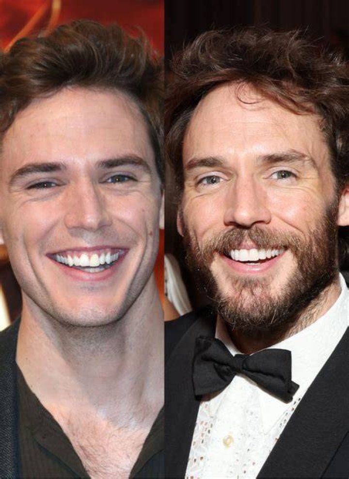 Is Sam Claflin Perfect Teeth Reason Behind His Pearly Smile? Before And After Pics
