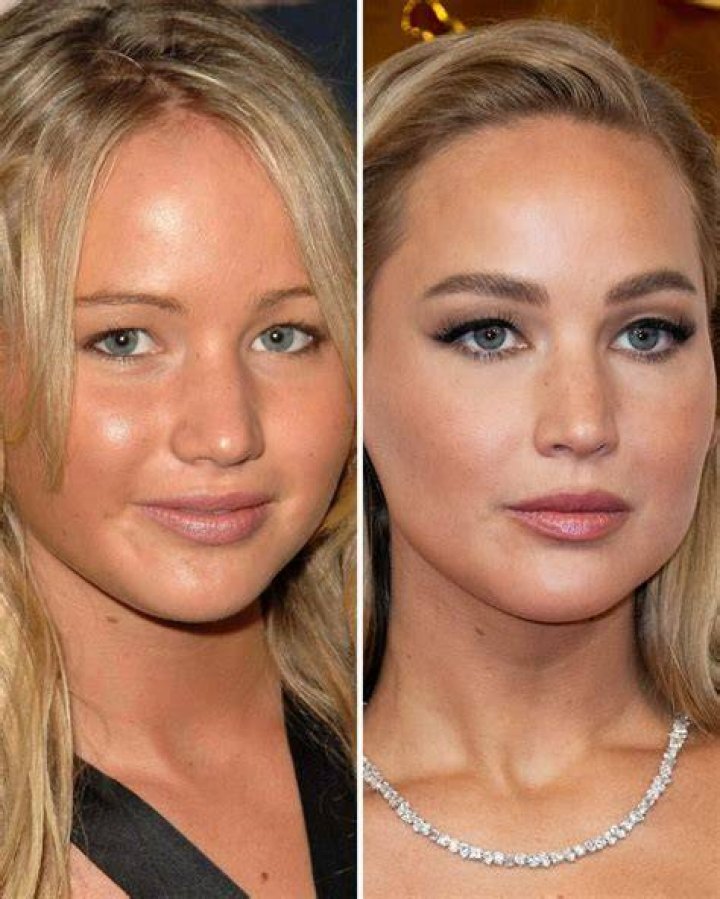 Jennifer Lawrence Before & After Plastic Surgery Makeover Exposed