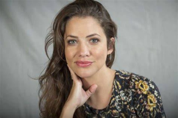 Julie Gonzalo's Facial Scar and 9 Other Things To Know About The Actress