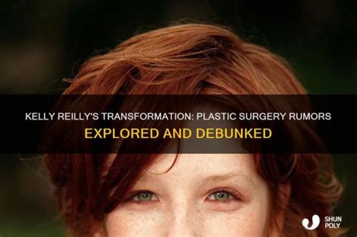 Kelly Reilly's Plastic Surgery Journey Explored