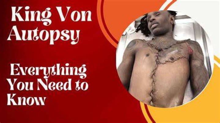 King Von Autopsy Report Details Reveal Cause of Death Digi Magazine