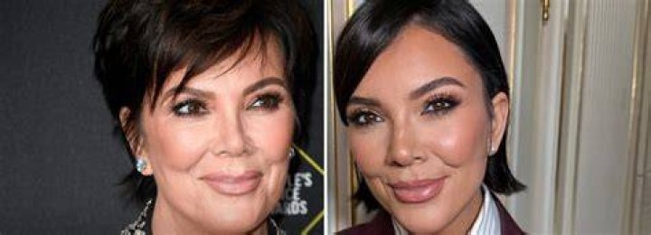 Kris Jenner perfekte plastische Chirurgie für 59 Jahre alte Mutter