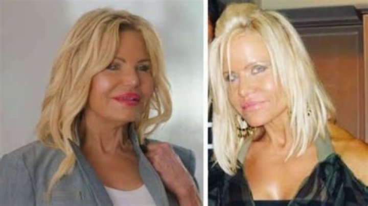 Lisa Helou Plastic Surgery NickyBenjimin