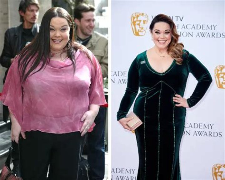 Lisa Riley Weight Loss Surgery WeightLossLook