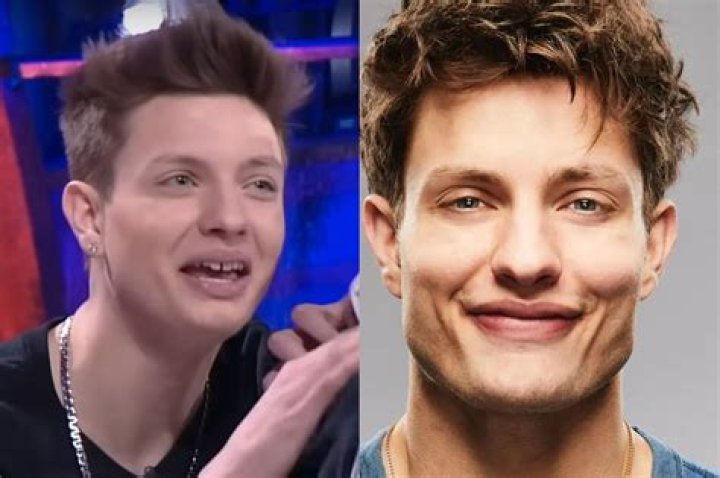 Matt Rife Before Fixing His Teeth The Wild ‘n Out Star’s Glow Up Examined!