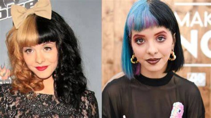 Melanie Martinez's Plastic Surgery Journey: Uncovering The Truth