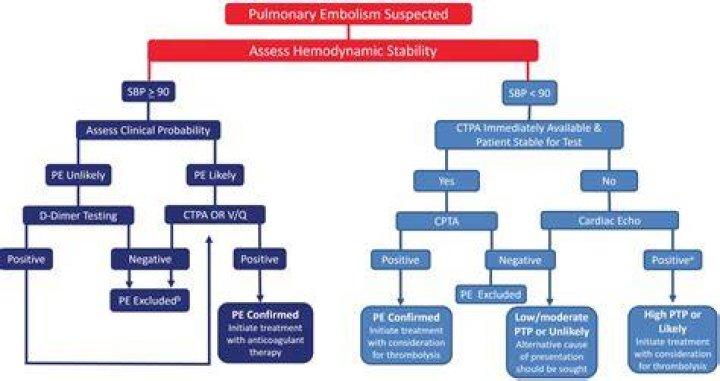 New Diagnostic Algorithm May Rule Out Deep Vein Thrombosis, Reduce