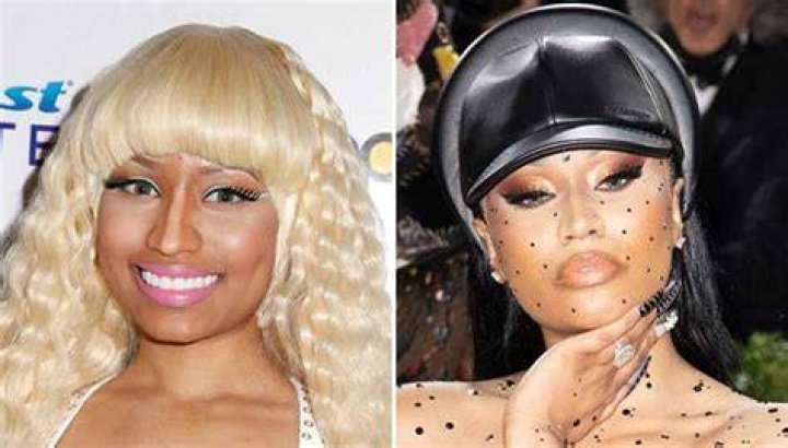 Nicki Minaj's Skin Bleaching Allegations And The Implications