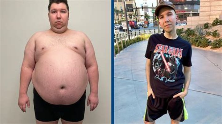 Nikocado Avocado weight loss is breaking the after Youtuber