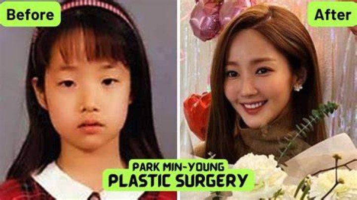Park Min Young's Pre-Surgery Journey