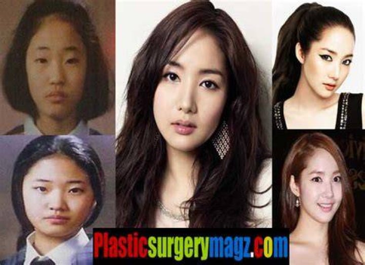 Park Min Young Plastic Surgery Before and After