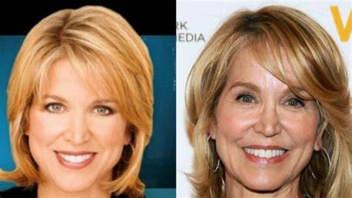 Paula Zahn Plastic Surgery Before And After
