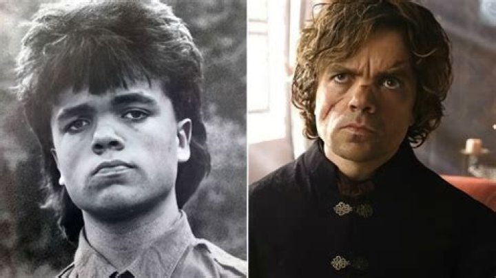 Peter Dinklage Childhood Story Plus Untold Biography Facts