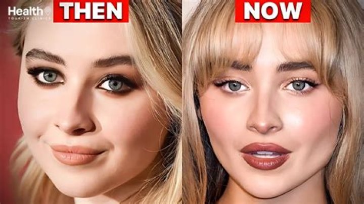 Sabrina Carpenter Plastische Chirurgie VorherNachher Fotos