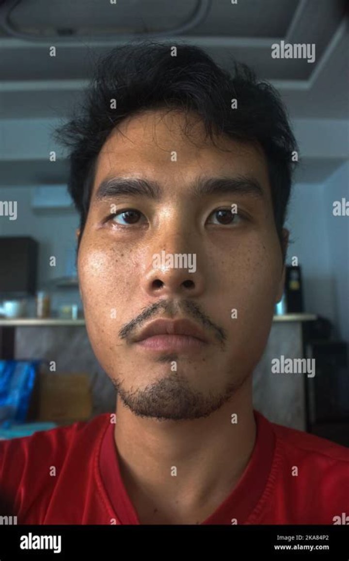 Sad video of 29yr old man who is still a baby as he cant grow due to a rare medical condition eme