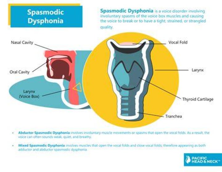 Spasmodic Dysphonia UCI Head and Neck Surgery UCI ENT Doctors